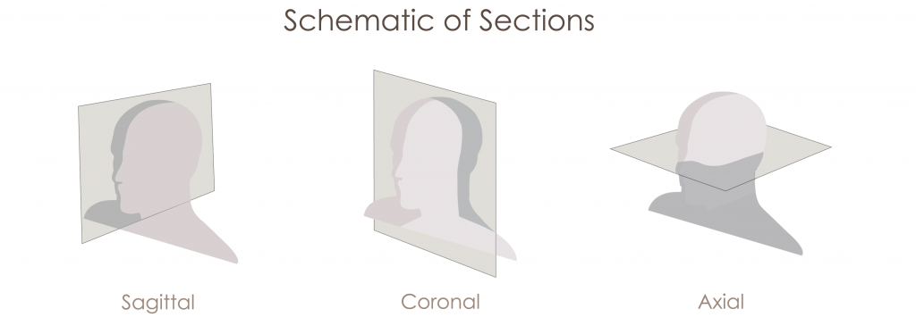 anatomical planes